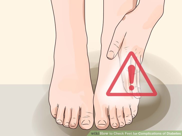 Check Feet for Complications of Diabetes Step 1 Version 2.jpg