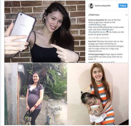 Nursing Mom Defended Kylie Padilla for Having Dark Underarms and Revealed Something That You Should Know!