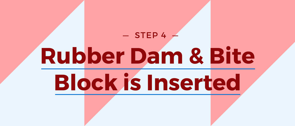 Step 4 Rubber Dam and Bite Block is Inserted