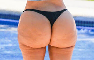 Kim Kardashian's cellulite butt