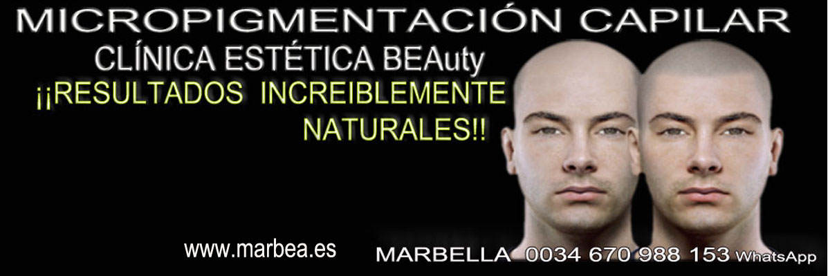 clinica estética, tatuaje capilar en Marbella o Marbella y maquillaje permanente en marbella