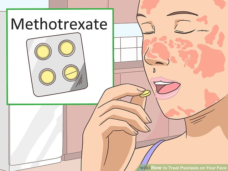 Treat Psoriasis on Your Face Step 3.jpg