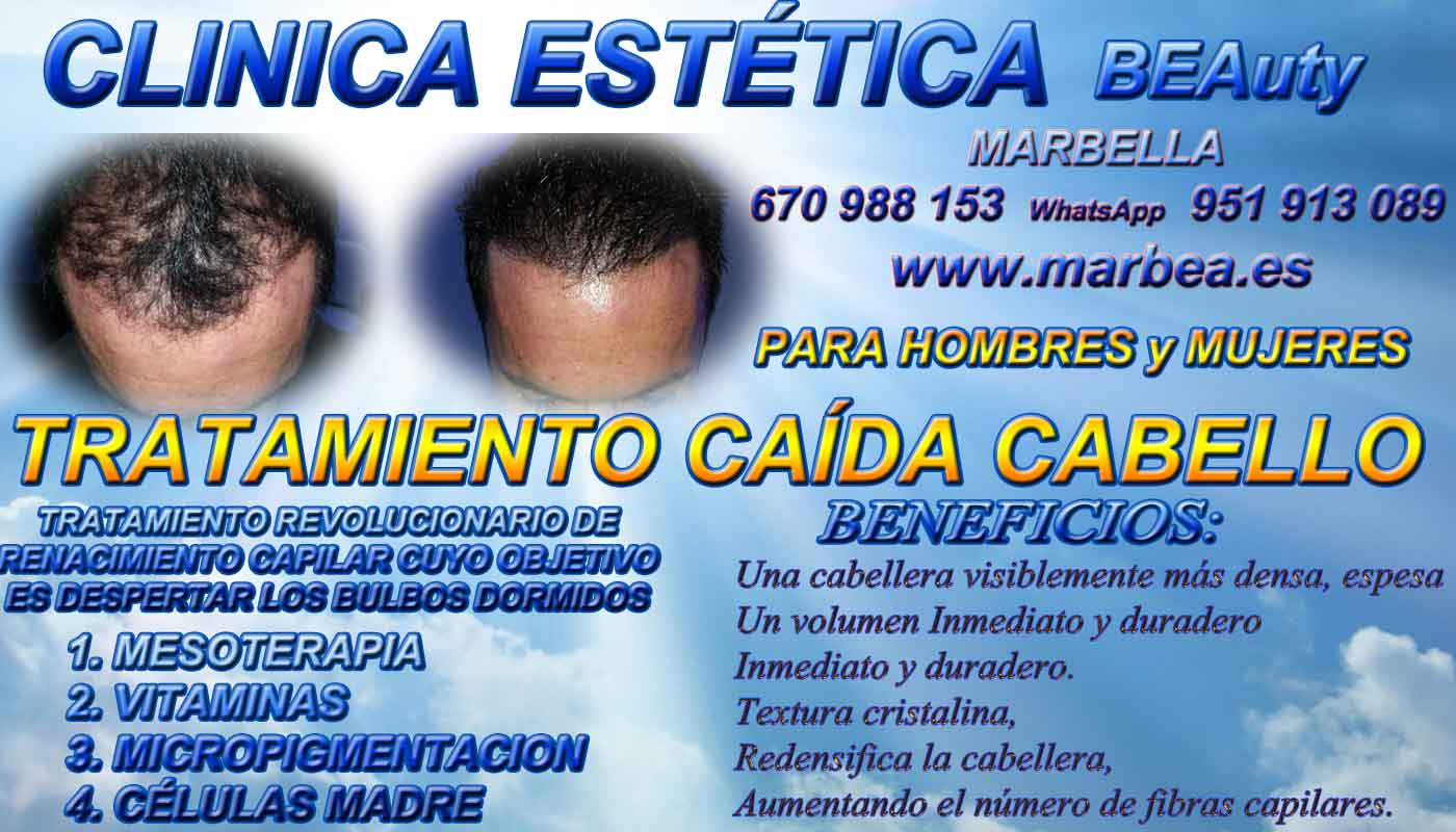 Implante cabello Clínica Estética y Injertos Capilar Marbella y Coin