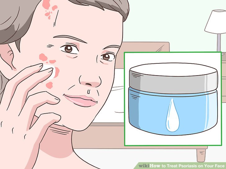 Treat Psoriasis on Your Face Step 8.jpg