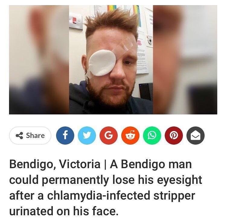 Guy has terrible picture after a stripper pees on his face.