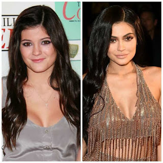 Kylie Jenner then and now photos