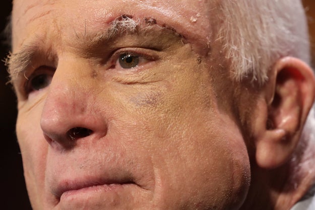 The decision by McCain, who was recently diagnosed with brain cancer, came as a shock to many of his colleagues — audible gasps could be heard in the Senate when he voted no.