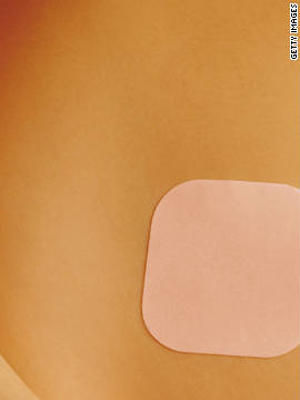 The Ortho Evra birth control patch was released in 2002. It is a small piece of beige plastic that sticks to the body and releases pregnancy-preventing hormones through the skin. Popular areas to stick the patch include the torso and the arm. A woman must change her patch once a week, for three weeks in a row. That is to be followed by one week without a patch before starting the cycle again.