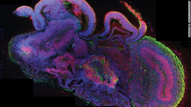 Scientists have created what they are calling "cerebral organoids" using stem cells. These pea-sized structures are made of human brain tissue, and they can help researchers explore important questions about brain development and disorders that occur during these first stages of life.
