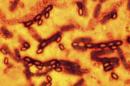 A microscopic picture of spores and vegetative cells of Bacillus anthracis which causes the disease anthrax