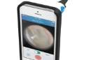 CellScope Oto enables at-home ear infection diagnoses